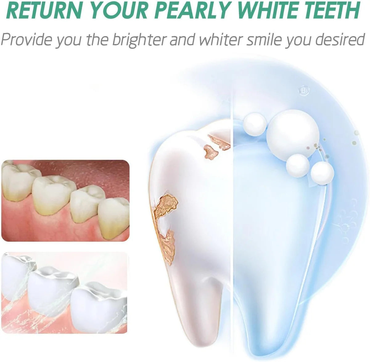 Eelhoe - Teeth Whitening Mouth Spray